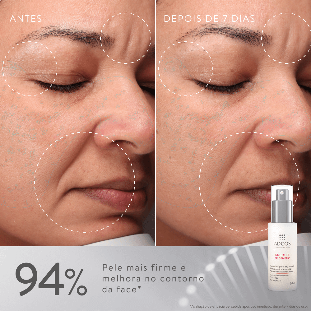 Nutralift Epigenetic